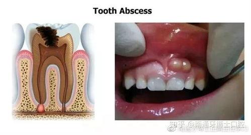 眼角膜发炎可以吃蜜瓜吗,蜜瓜食用指南